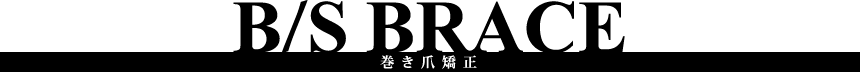 巻き爪矯正
